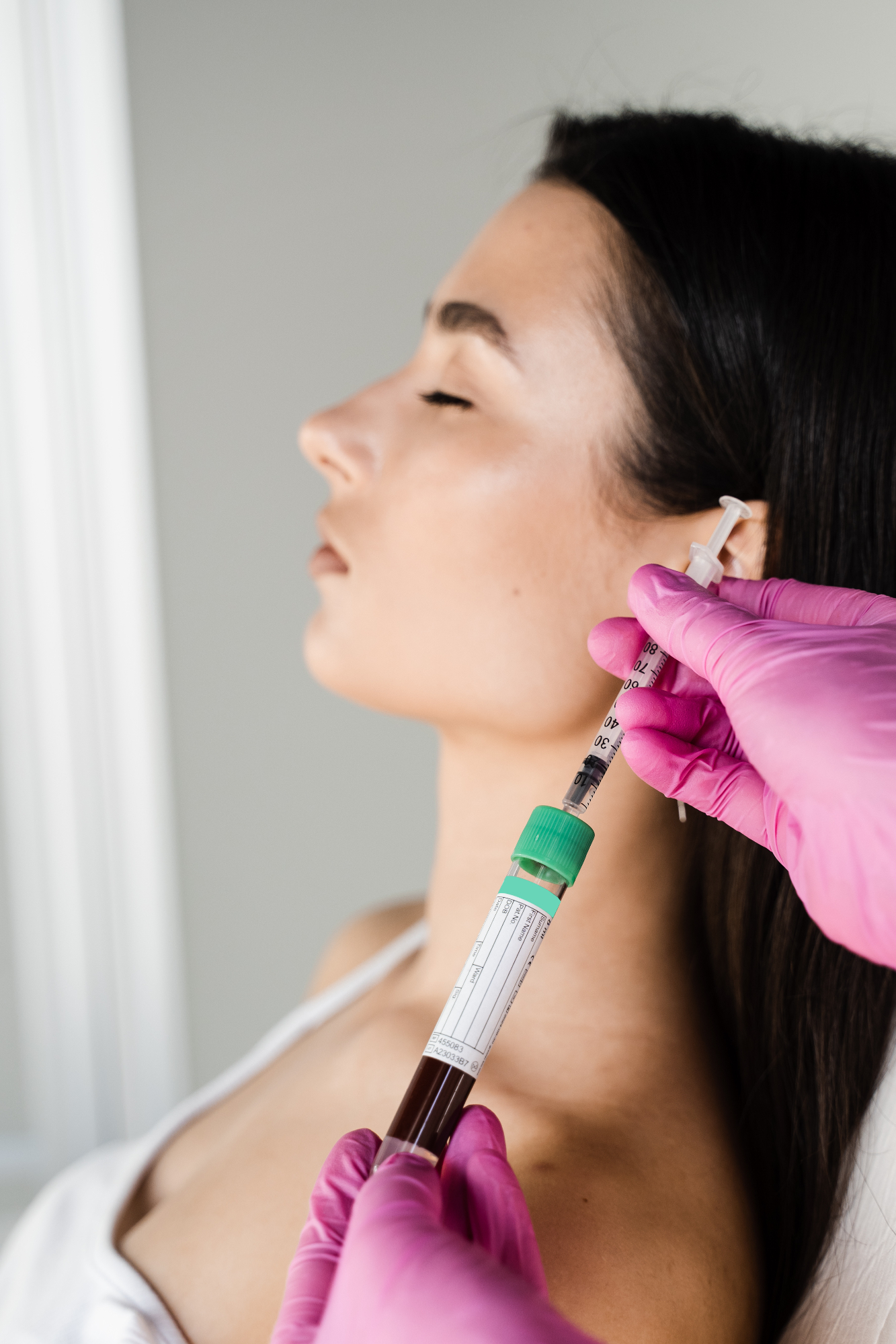 Moje lice i botox: osobna priča o promjeni i reakcijama koje su uslijedile